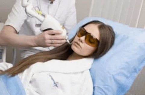 frakcijsko lasersko pomlađivanje